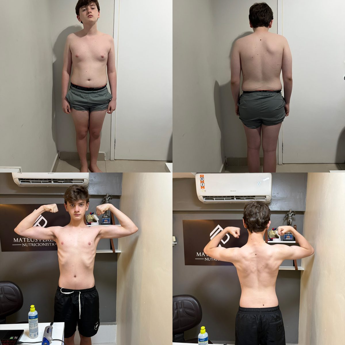 Antes e depois de Nicolas Brito